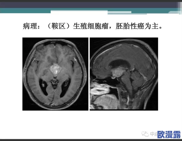 裸体大隂户特写：研究生物学中的生殖结构及其对生态系统的重要影响与应用