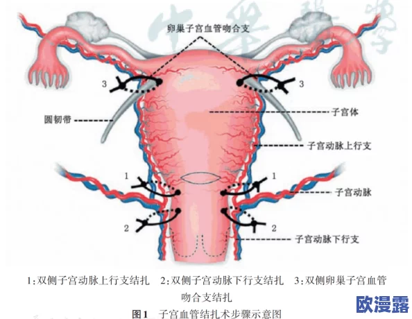 破苞XXXX出血HD：探讨产后出血的原因、处理方法及预防措施的综述与研究分析