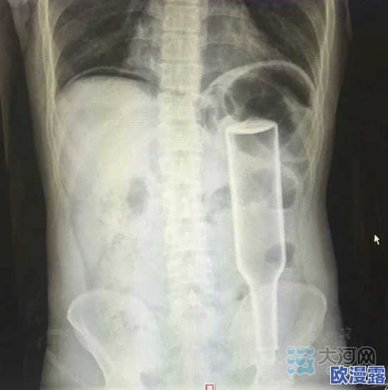 可以用几支棉签插肛门，这个问题引发了人们对安全和健康的关注，探讨其潜在风险与正确使用方法