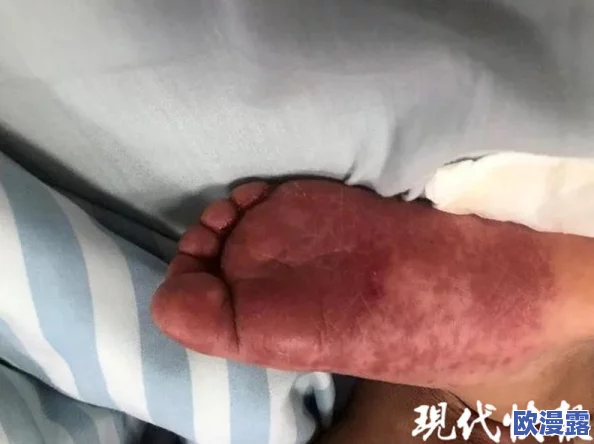 尿道口两边的肉肿了的原因：警惕！可能是这些常见疾病在作祟，快来了解真相！